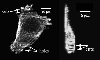 Central slice (left) and side view (right) of a cell photodisrupted by 100-fs laser pulses seen by fluorescence confocal microscopy.