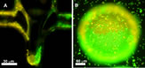 Microfluidic Assembly of Colloidal Armor