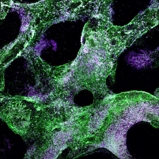 human neural progenitor cells differentiate into multiple cell types, including oligodendrocytes that produce myelin